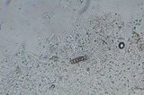 Phanerochaete sanguinea image