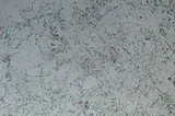 Phanerochaete sanguinea image