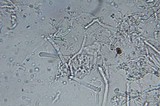 Phanerochaete sanguinea image