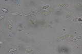 Cymatoderma caperatum image