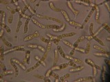 Dacrymyces stillatus image