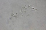 Xylaria liquidambar image