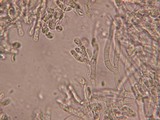 Ceriporia reticulata image