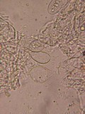 Aleurodiscus aurantius image