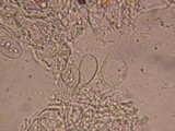 Aleurodiscus aurantius image