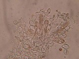 Aleurodiscus aurantius image