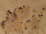 Aleurodiscus aurantius image