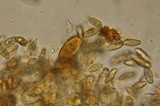 Rubroboletus dupainii image
