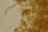 Rubroboletus dupainii image