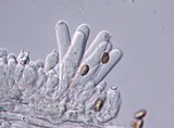 Lacrymaria echiniceps image