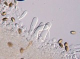 Lacrymaria echiniceps image