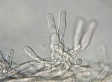Lacrymaria echiniceps image