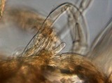 Lacrymaria echiniceps image