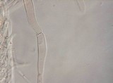 Lacrymaria echiniceps image