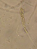Diatrype disciformis image