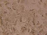 Diatrype disciformis image
