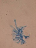 Phanerochaete deflectens image