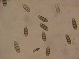 Thyridaria rubronotata image