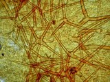 Cheilymenia stercorea image