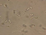 Exidiopsis grisea image
