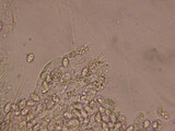 Mycolindtneria leucobryophila image
