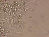 Mycolindtneria leucobryophila image