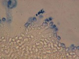 Mycolindtneria leucobryophila image