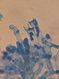 Mycolindtneria leucobryophila image