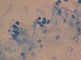 Mycolindtneria leucobryophila image
