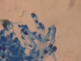 Mycolindtneria leucobryophila image