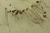 Rhizina undulata image