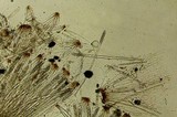 Rhizina undulata image