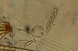 Rhizina undulata image