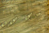 Rhizina undulata image