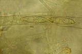 Rhizina undulata image