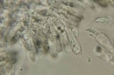 Lepiota magnispora image