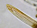 Lophodermium pinastri image