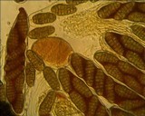 Pleospora herbarum image