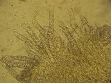 Hyphoderma setigerum image