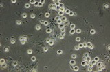 Ceratiomyxa fruticulosa var. fruticulosa image