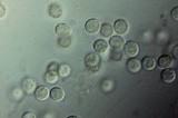 Ceratiomyxa fruticulosa var. fruticulosa image