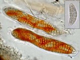 Gloniopsis praelonga image