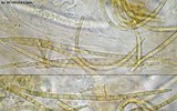 Ophiobolus niesslii image