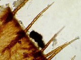 Torrendiella ciliata image