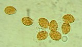 Cortinarius infractus image