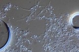 Penicillium melinii image