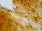 Rutstroemia calopus image