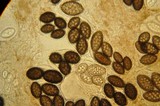 Tuber melanosporum image