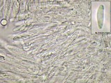Pyrenopeziza pulveracea image