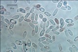 Byssomerulius corium image